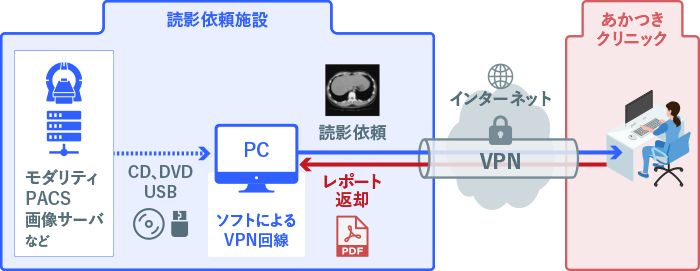 インターネットVPNによる簡易型システム「Pigeon Net」