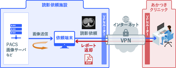 インターネットVPNによる常時接続システム